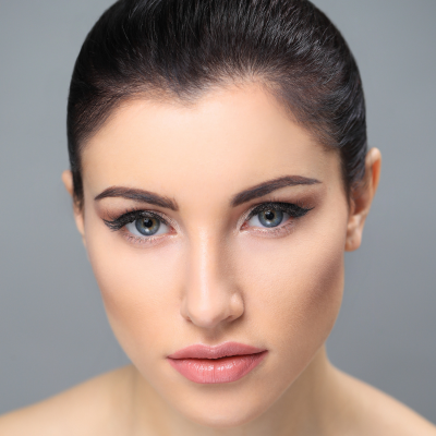 Cheek Contouring: 1 Syringe Stylage