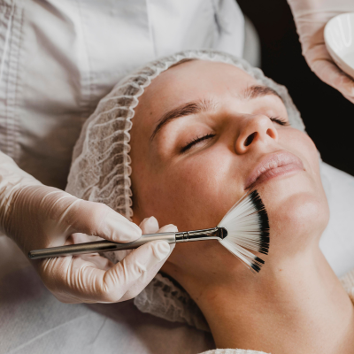 Chemical Peel