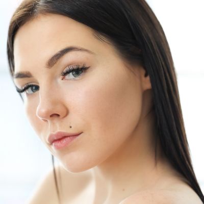 Chin Contouring: 1 Syringe Stylage