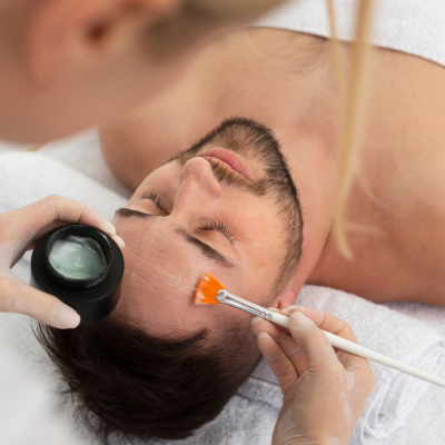 Men: Chemical Peel: Face