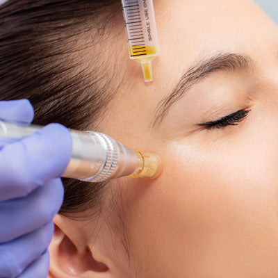 Microneedling: Face